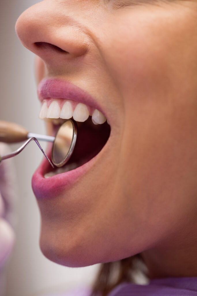 Dentista examinando com instrumental espelho uma boca feminina